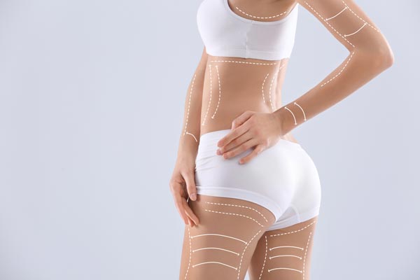 Post-Bariatric Body Contouring Baltimore