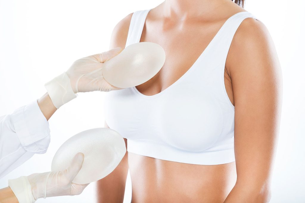 Breast Implant Exchange